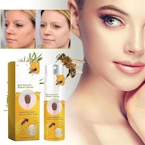Bee Venom Skin Tag Removal Spray, Tag Recede Bee Venom Treatment Spray, Bee Venom Wart and Tags Removal Treatment Spray,Lymphatic Drainage