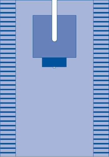 Medline EENT Split Drape, Sterile, SMS Fabric, 78 Inches x 121 Inches, with Absorbent Reinforcement and Adhesive Split, Case of 8 Each