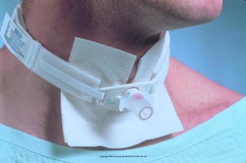 Disposable Trachea Tube Holder [TRACH TUBE HLDR NEONATE TO INF]