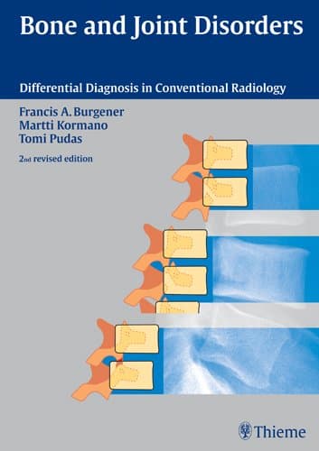 Bone and Joint Disorders (Encyclopedia of Differential Diagnosis in Dermatology) Plastic Comb – 23 Nov. 2005