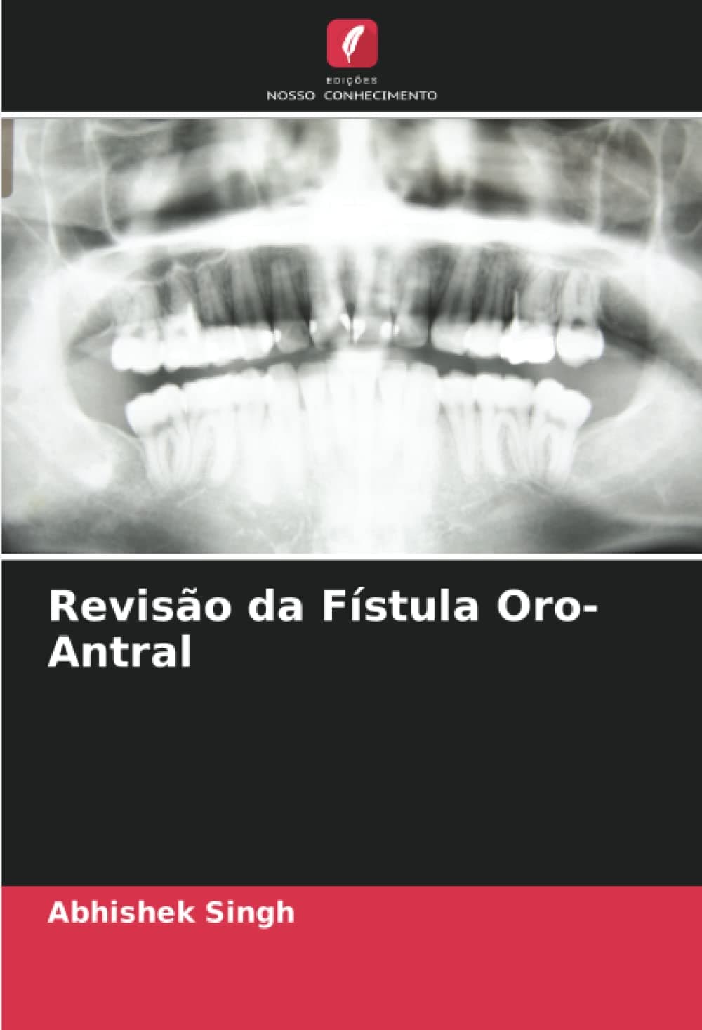 Revisão da Fístula Oro-Antral