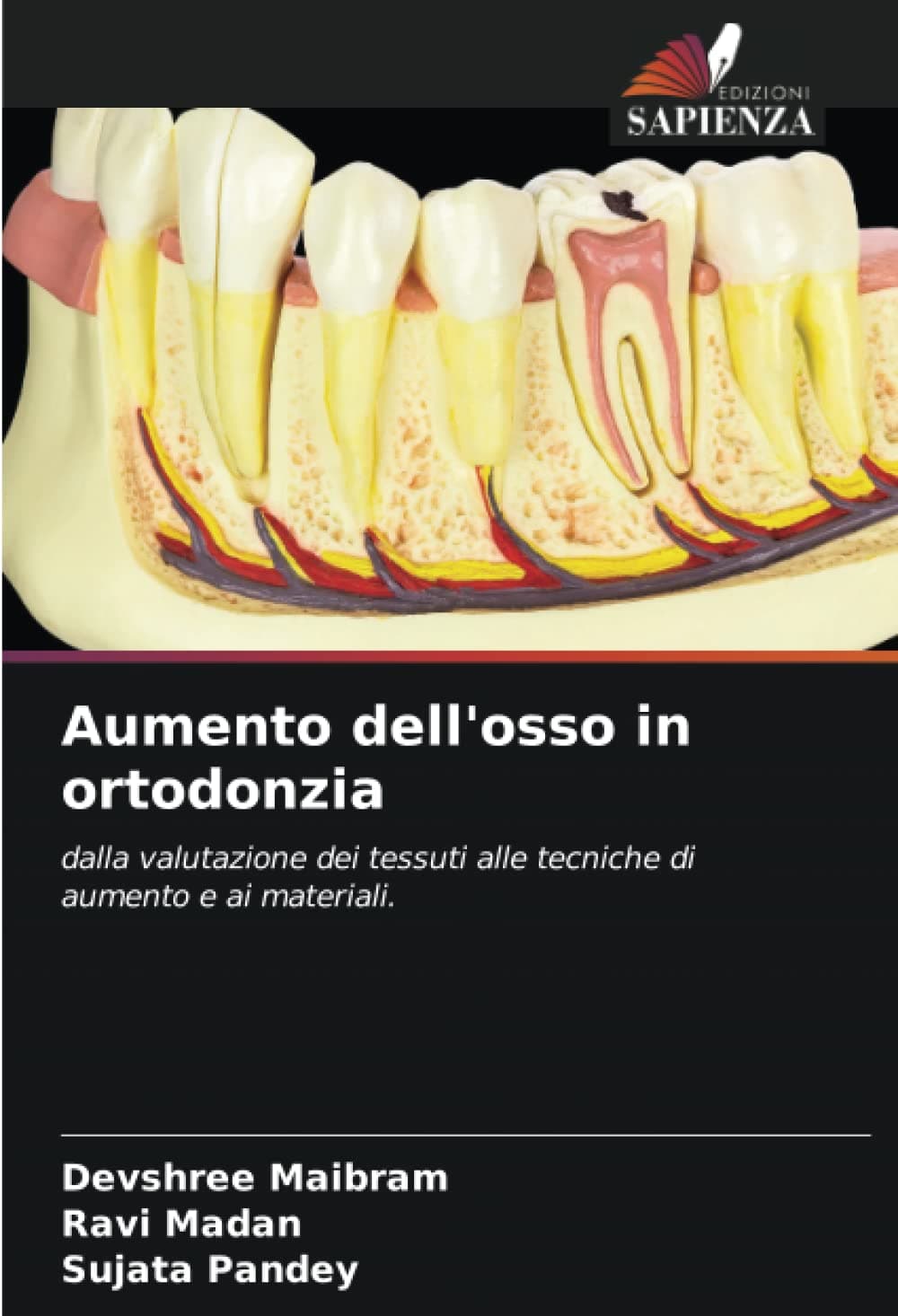 Aumento dell'osso in ortodonzia: dalla valutazione dei tessuti alle tecniche di aumento e ai materiali. (Italian Edition)