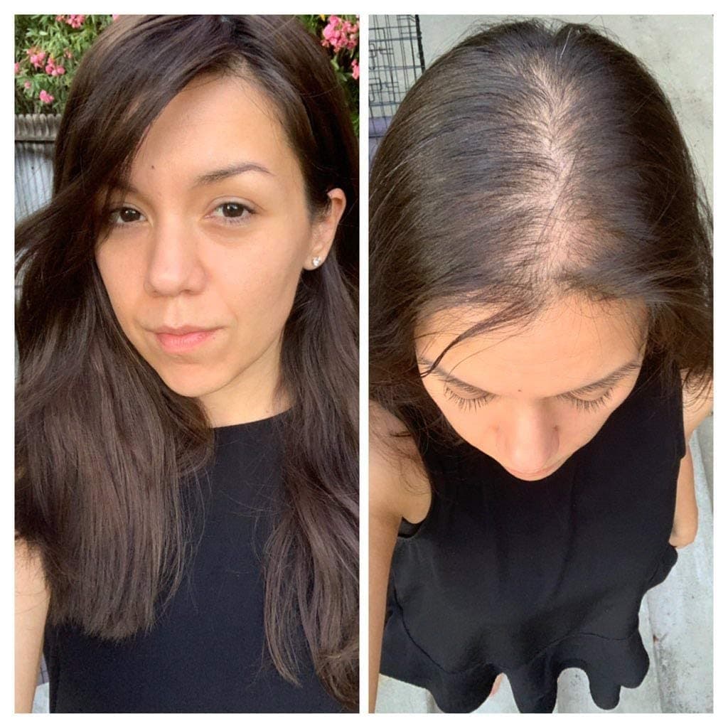 Gramercy Human Hair Clip-in Toppers for Women - Straight/Thin Crown Extensions for Hair Loss -16