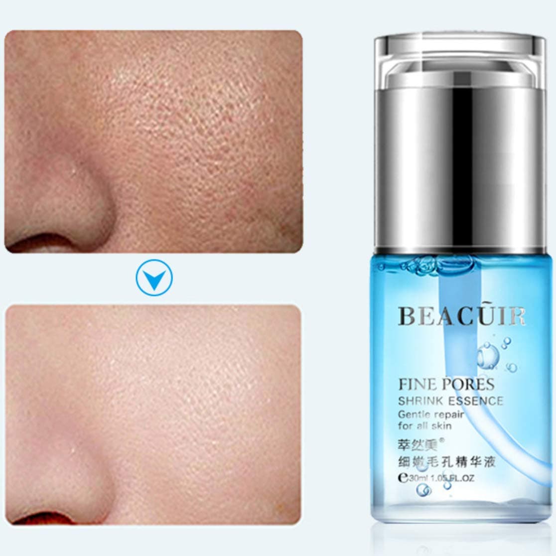 Fine Pores Shrink Essence Repair Acne Blackhead Remover Cleansing Dry Skin Black Spots Dirty Pores 30 ml