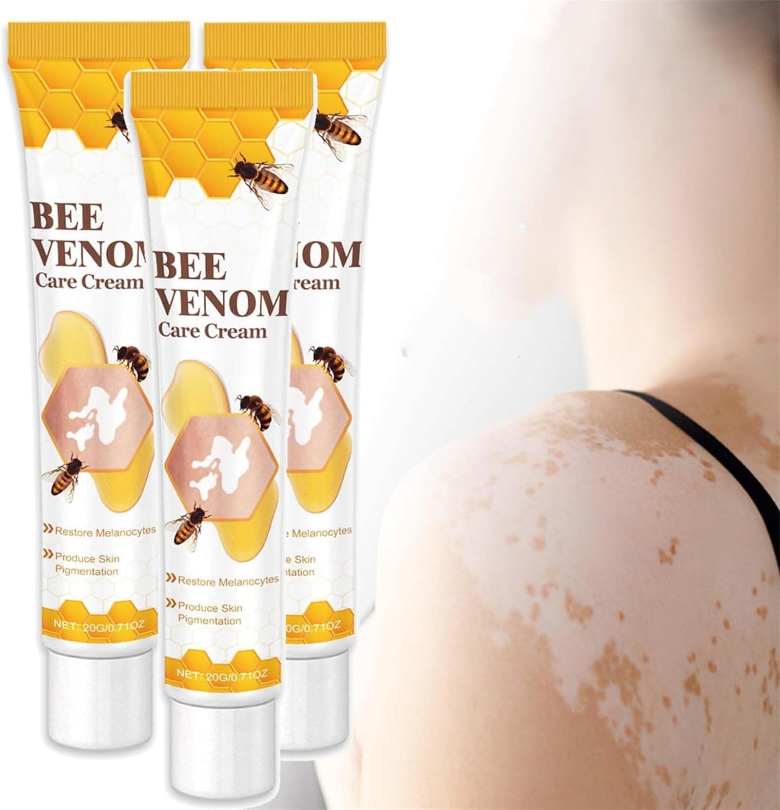 Vitiligo Bee Venom Treatment Cream, Fivfivgo Beevenom Vitiligo Treatment Cream, Bee Venom Vitiligo Cream, for All Skin Types (3Pcs)