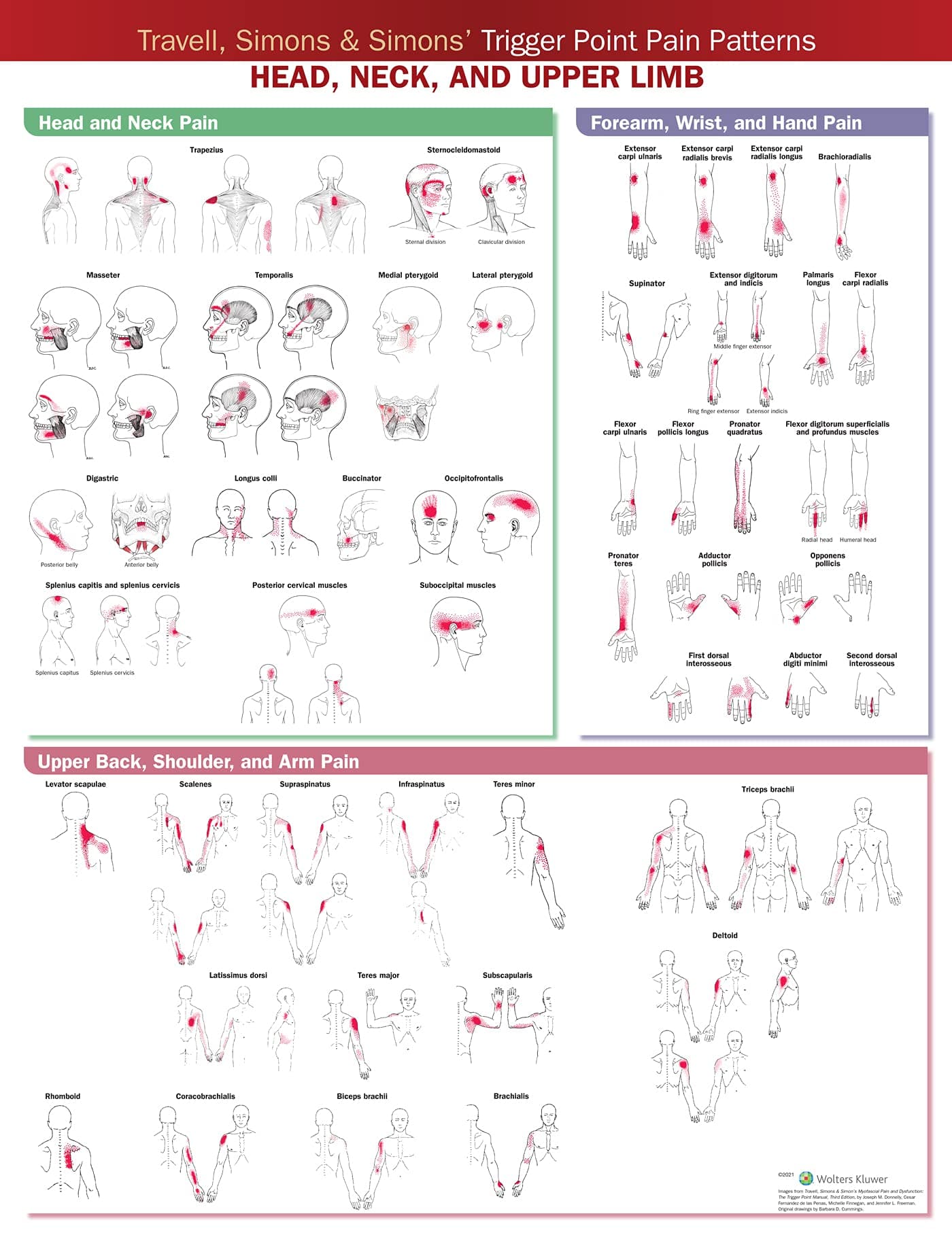 Travell, Simons & Simons’ Trigger Point Pain Patterns Wall Chart: Head, Neck, and Upper Limb