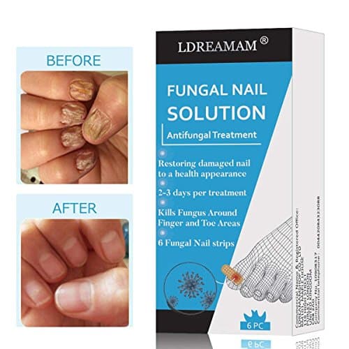 Nail Fungus,Antifungal Nail Treatment,Toenail Fungus Treatment,Antifungal Nail Gel,Removal of Fingernail and Toenail Fungus