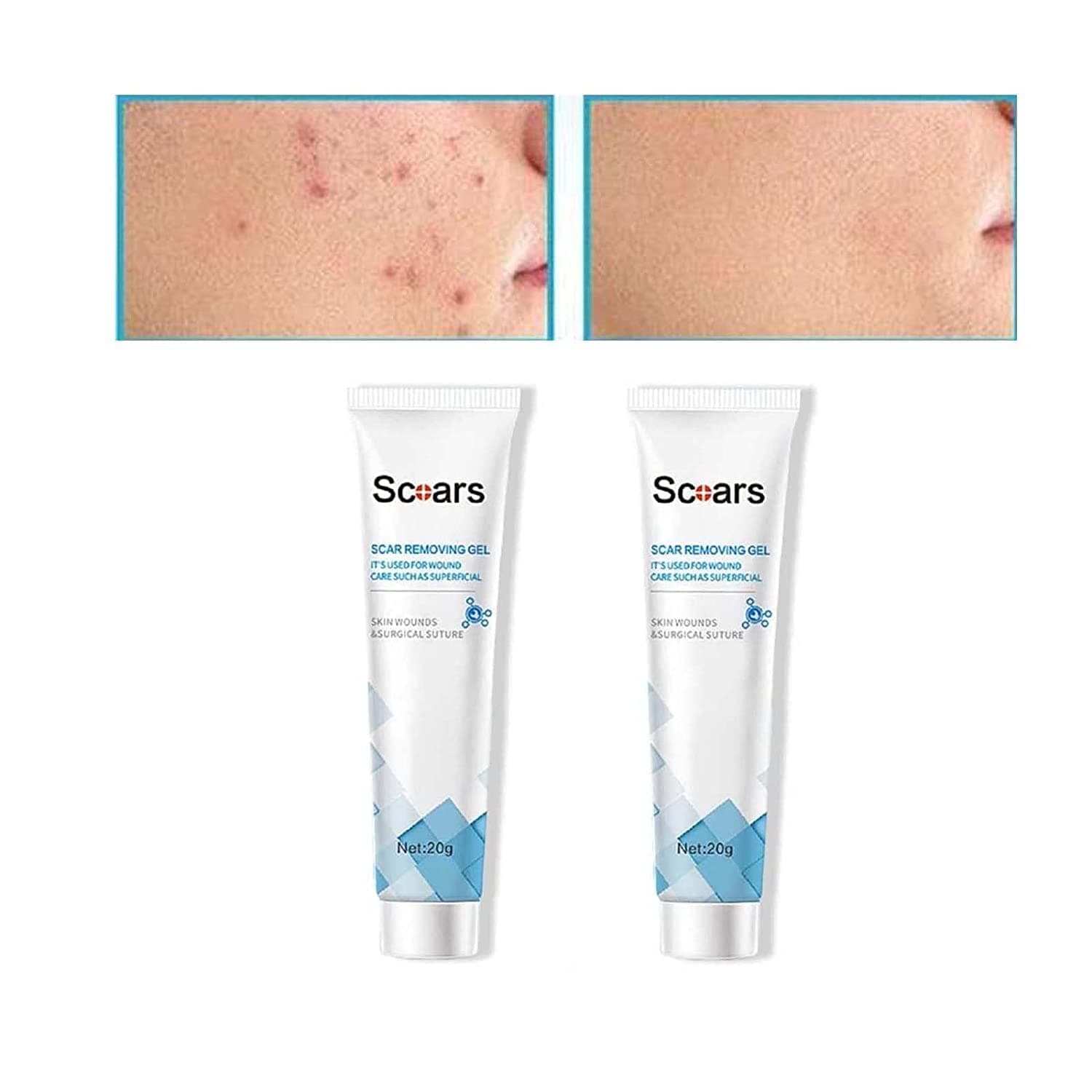 Scar Cream for Surgical Scars,Keloid Scar Removal Cream,for Surgical Scars Old Scar,for Lightening Scars and Acne Marks,Suitable for Sensitive Skin (2pcs)