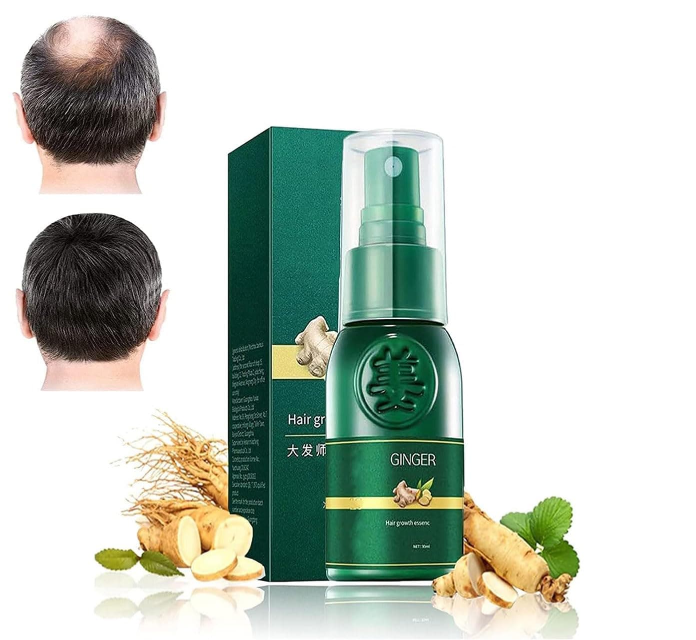 HyunGang Korea Ginseng Hair Regrowth Serum Spray, 7 Days Ginger Hair Growth Spray Serum, 10 X Stimulate Hair Growthplus Hair Regrowth Essence, Nourishing Ginger Spray for Women & Men