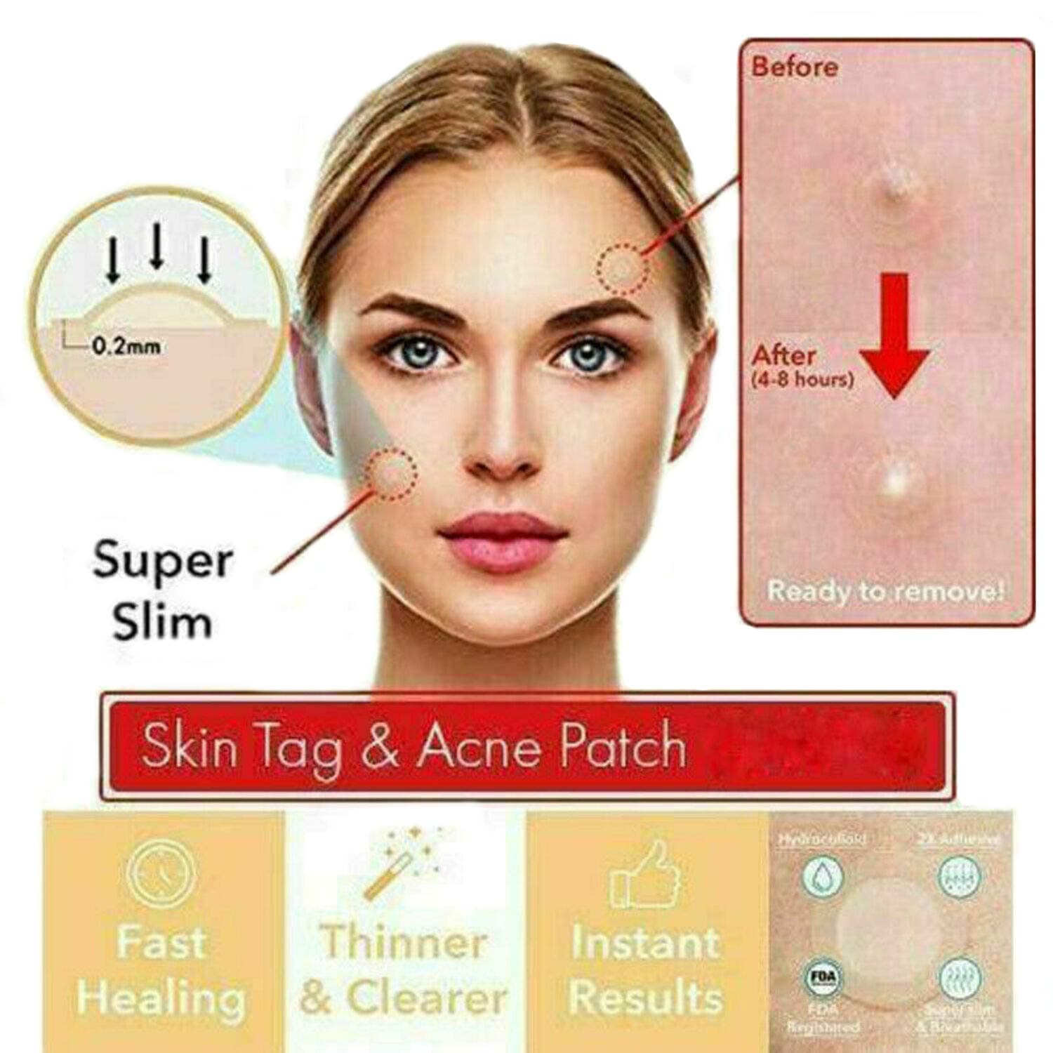 Petano 2019 THE MAGIC SKIN PATCH - 24Pcs Skin Tag Removal Patch Blackhead Blemish Removers