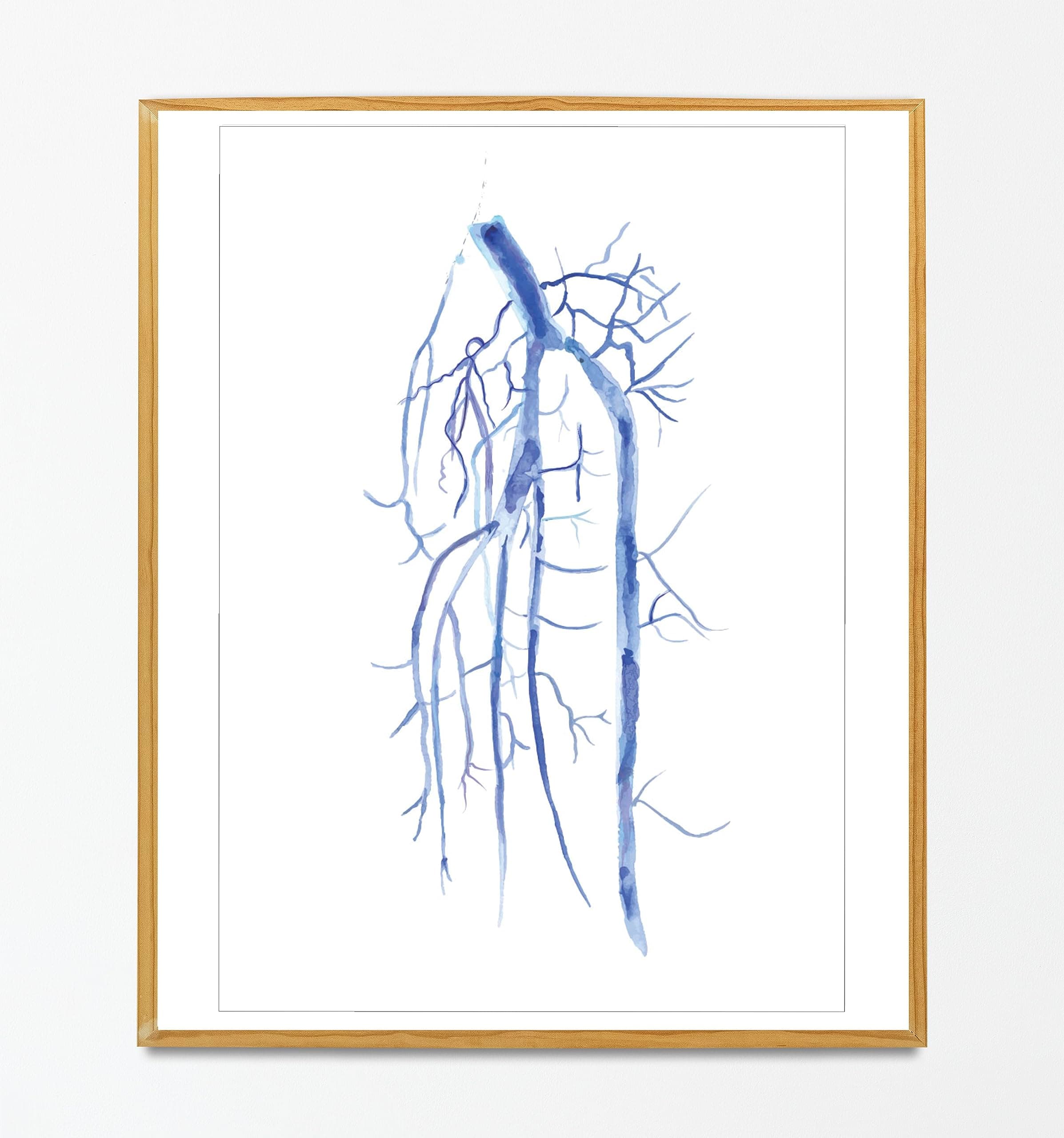 Radiology Art - Radiology Gifts, Popliteal Artery DSA, Interventional Radiology Gifts, Vascular Surgeon Gifts, Vascular Surgery, Radiology Office Decor, Fine Art Print (16x20 in)